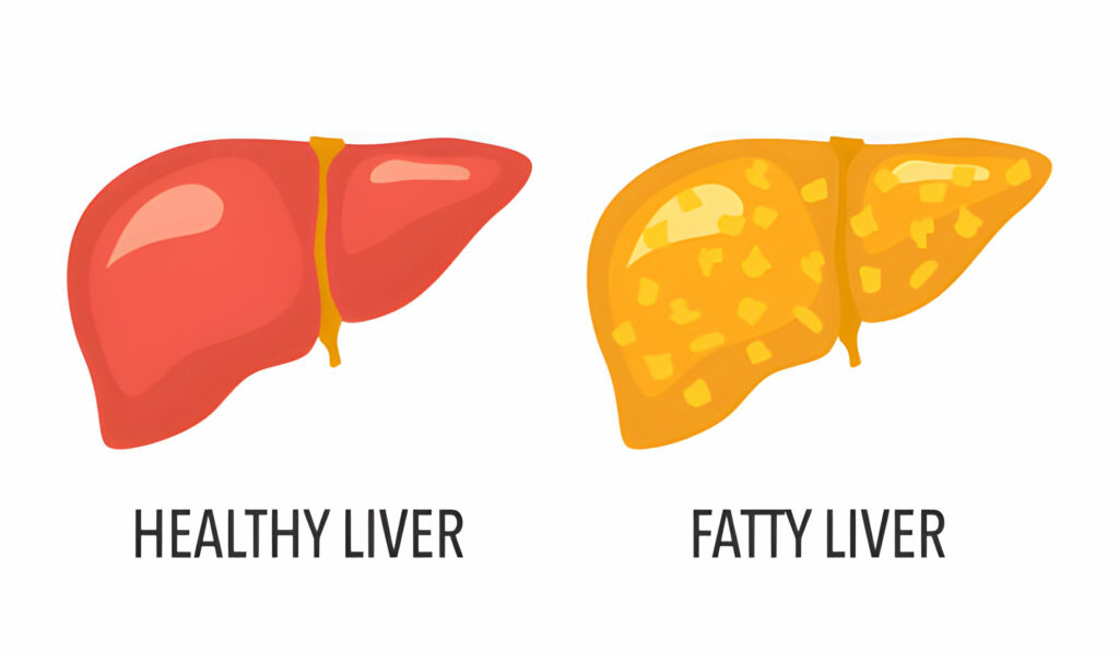 what is healthy liver